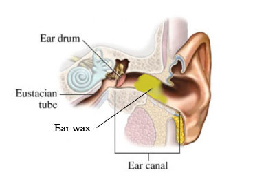 fire ear wax removal